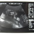 Echo040922_1