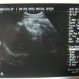 Echo050105